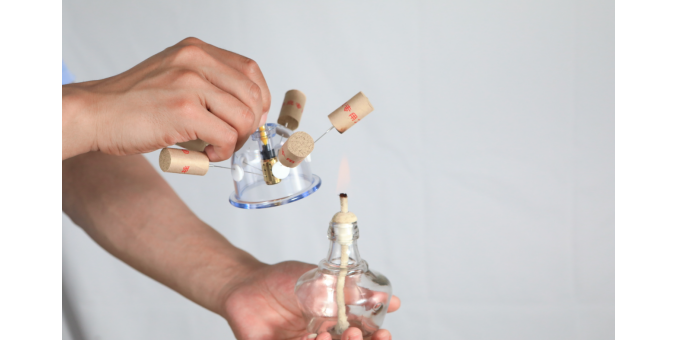 宇泉罐診罐療的發(fā)明與創(chuàng)新