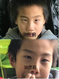 妙醫(yī)堂精手法傳承人&mdash;&mdash;王浩丞