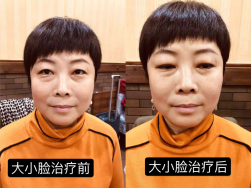 妙醫(yī)堂精手法傳承人&mdash;&mdash;王浩丞